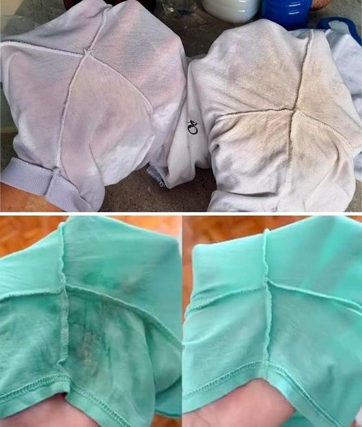 Aprendi como tirar manchas de desodorante das roupas rapidamente usando apenas 2 ingredientes